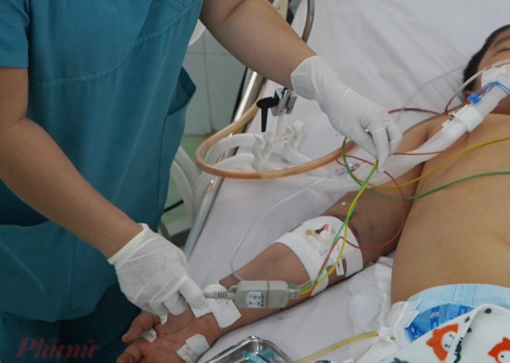 trẻ mắc sốt xuất huyết nặng được điều trị tại khoa Nhiễm, Bệnh viện Nhi đồng 2 TPHCM