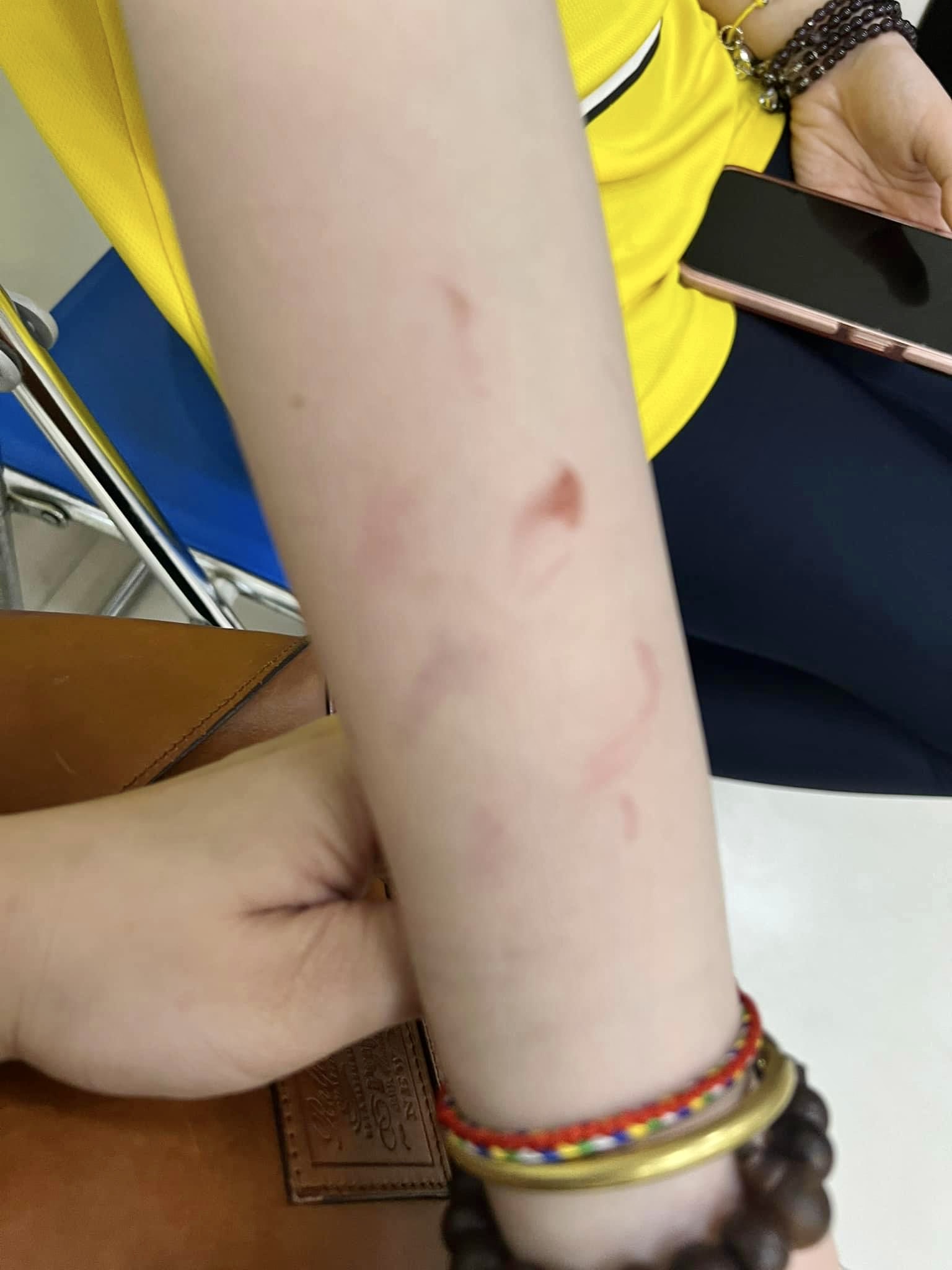 Hình ảnh nữ sinh bị bạo lực ở Trường Quốc tế American Academy 