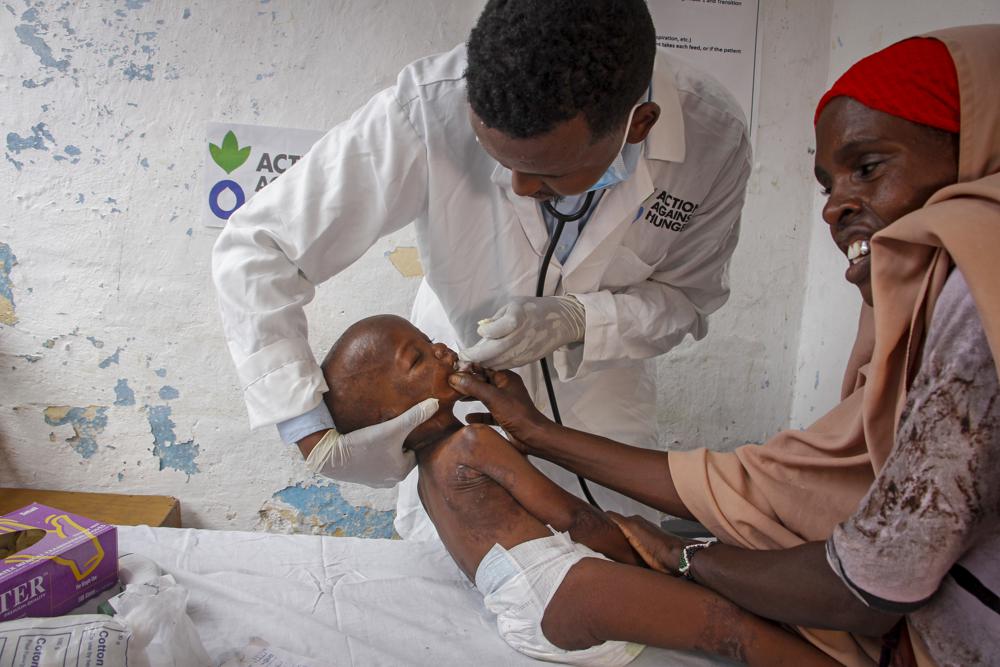 Bác sĩ Mustaf Yusuf chăm sóc Ali Osman với sự trợ giúp từ mẹ của cậu bé, Owliyo Hassan Salaad (40 tuổi) tại một trung tâm điều trị suy dinh dưỡng do Tổ chức Hành động chống lại nẹn đói điều hành, ở Mogadishu, Somalia