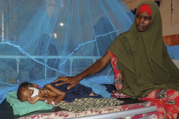 Một cậu con trai Adan một tuổi của cô khi cậu bé được cho ăn qua ống để điều trị chứng suy dinh dưỡng cấp tính nghiêm trọng của mình, tại trung tâm ổn định của Bệnh viện Khu vực Bay ở Baidoa, Somalia