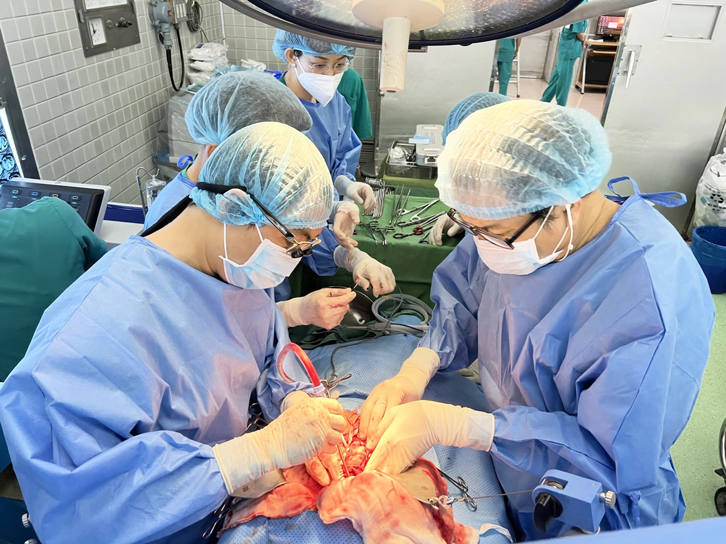 Tiến sĩ - bác sĩ Đoàn Tiến Mỹ (bên phải) - Trưởng khoa Ngoại gan - mật - tụy Bệnh viện Chợ Rẫy - đang thực hiện mổ chính cho một trường hợp ung thư đường mật rốn gan - ẢNH: BỆNH VIỆN CUNG CẤP