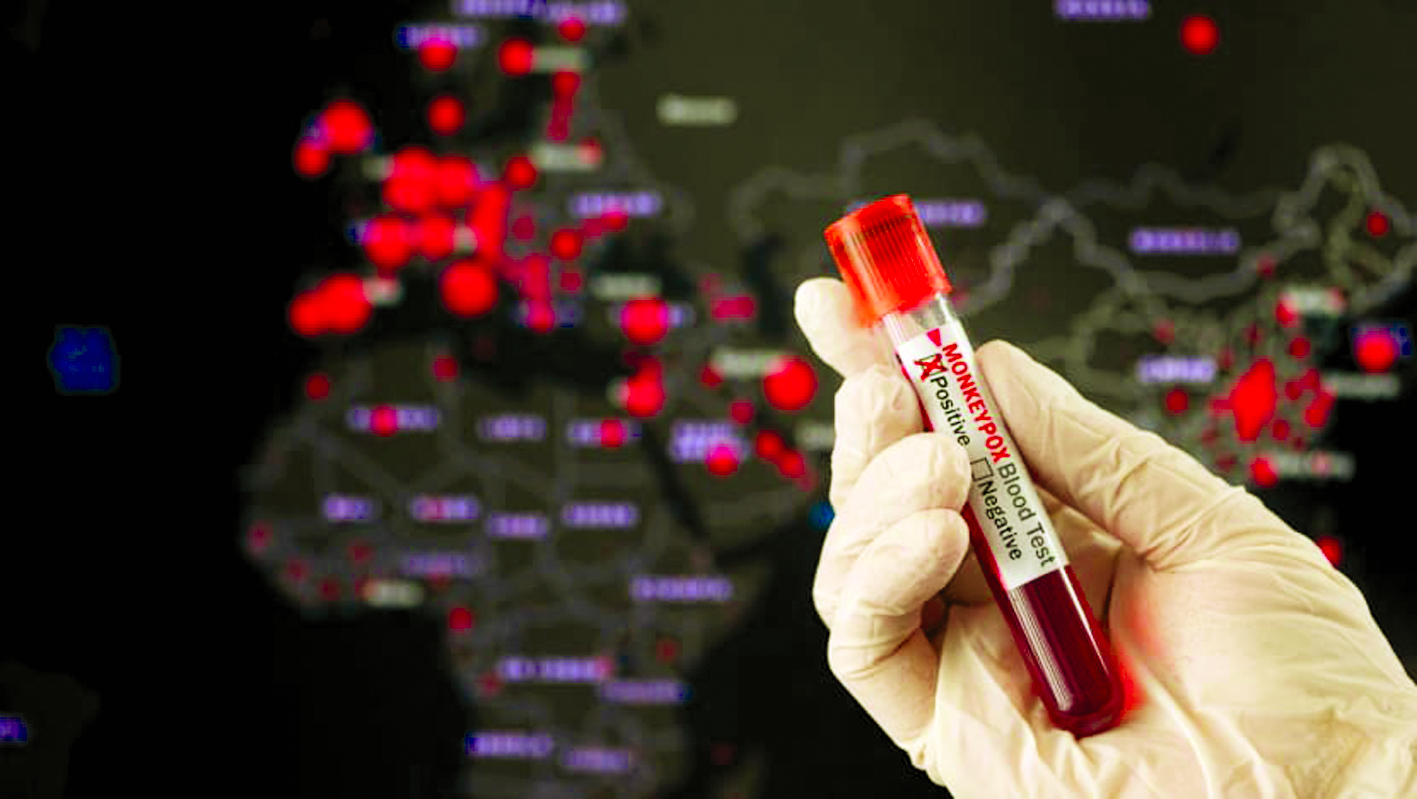 Một mẫu máu có kết quả xét nghiệm dương tính với vi-rút đậu mùa khỉ - ẢNH: ISTOCK