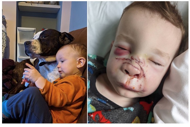 Bé Romy cùng chó Pitt Bull lúc chưa xảy ra vụ việc (bên trái) và khuôn mặt bị thương của cậu bé sau khi bị chó Pitt Bull tấn công (bên phải) - Ảnh: City Watch