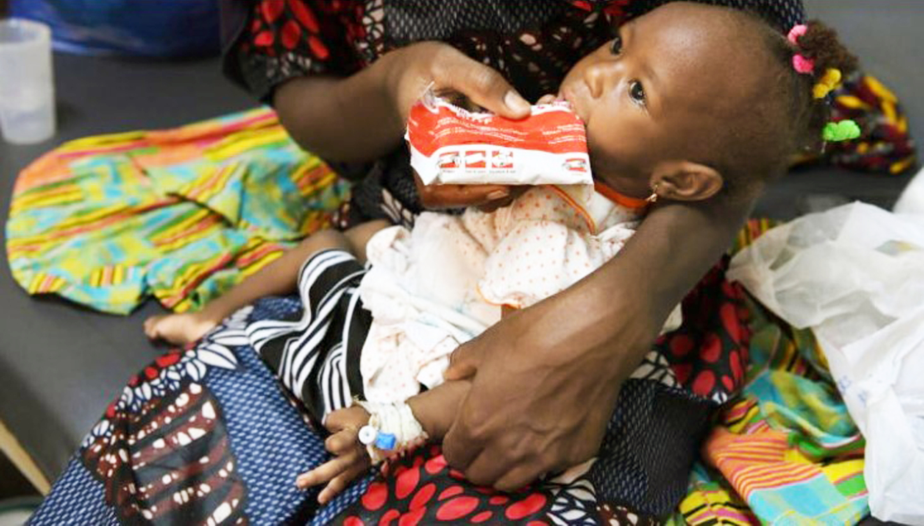 Một bé gái suy dinh dưỡng ở khu vực Sừng châu Phi đang được cho dùng thực phẩm dinh dưỡng chuyên biệt - ẢNH: UN