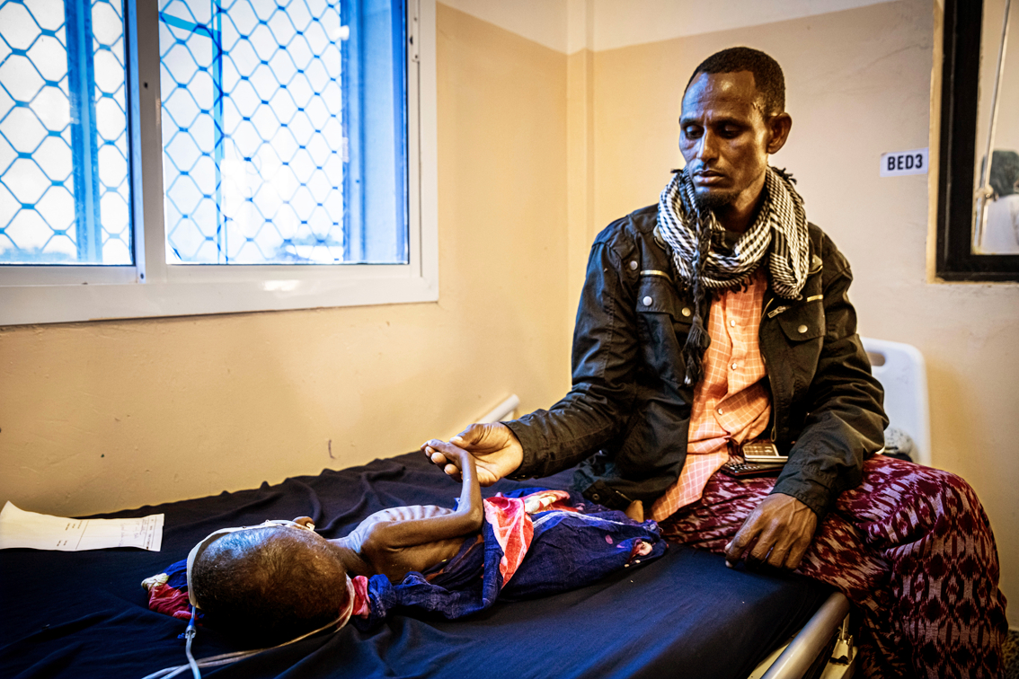 Một người cha bên cạnh đứa con bị suy dinh dưỡng cấp tính nghiêm trọng, được điều trị tại Bệnh viện Phụ sản và Trẻ em  Banadir ở Mogadishu, Somalia - ẢNH: GETTY IMAGES