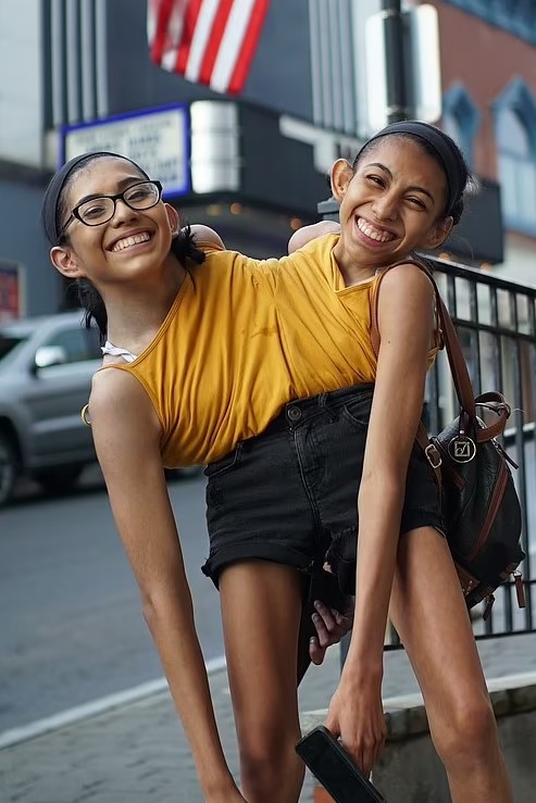 Khi Lupita và Carmen còn nhỏ, họ đã dành nhiều năm tập vật lý trị liệu để học cách ngồi dậy và làm việc cùng nhau. Và khi họ 4 tuổi, họ đã cùng nhau bước những bước đầu tiên.