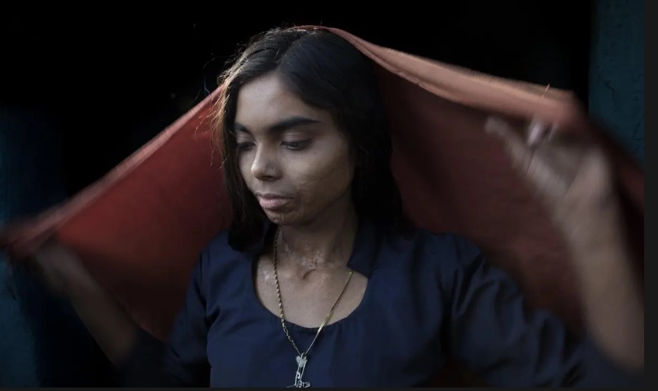 Một bức chân dung của Savitri được chụp vào năm 2016 khi cô 16 tuổi. Cô đeo một chiếc khăn quàng cổ khi rời khỏi nhà để che đi những vết sẹo do bỏng khi quần áo của cô bị cháy ở xưởng đúc. Bây giờ ở độ tuổi ngoài 20, Savitri đang được đào tạo để trở thành y tá. Công việc của cô ấy tại mỏ giúp tài trợ cho việc học của cô ấy. Cô cũng nhận được hỗ trợ tài chính từ Coalfield Children Classes , một tổ chức phi chính phủ. “Tôi vẫn đang làm việc trong các mỏ than vì tôi không có lựa chọn nào khác,” cô nói. “Nếu tôi kiếm được một công việc điều dưỡng, tôi sẽ có thể bảo vệ gia đình mình tốt hơn”