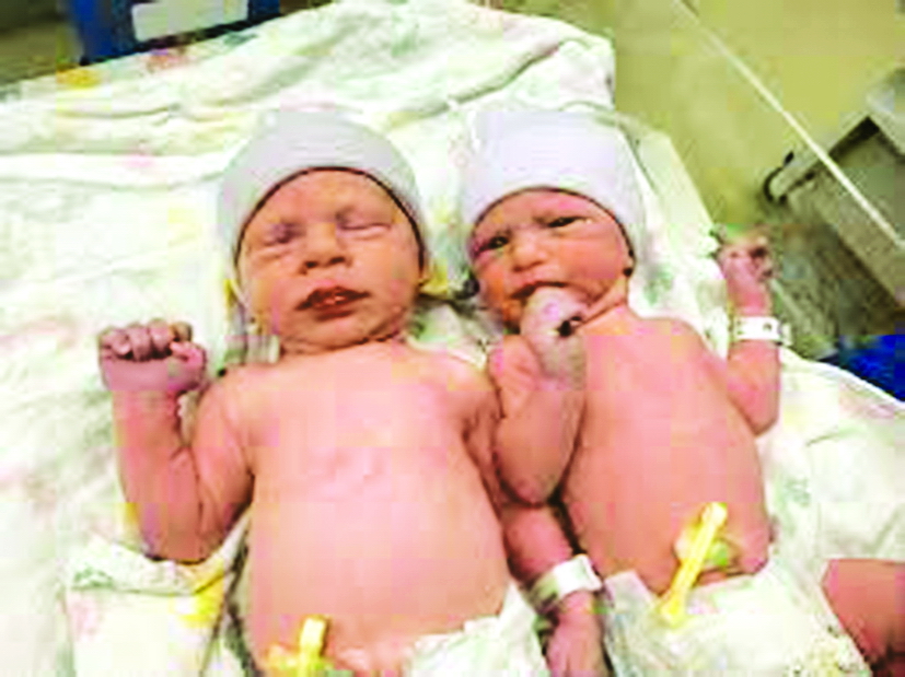 Cặp song sinh được sinh ra từ phôi thai đông lạnh cách đây 30 năm - ẢNH: CNN
