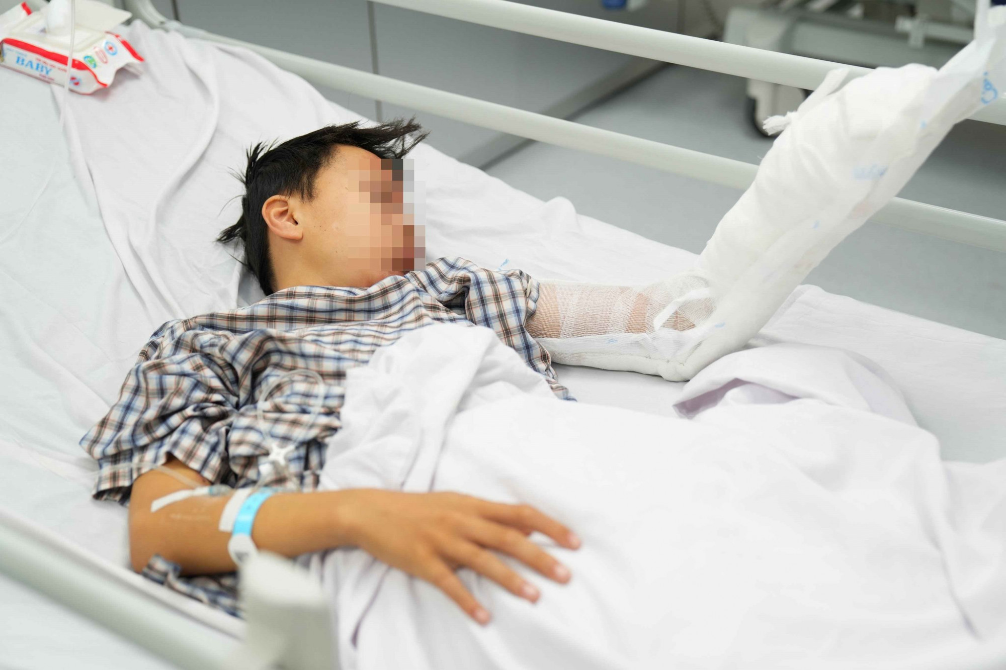 Bé trai 13 tuổi bị dập nát tay khi dùng bình gas mini nấu ăn