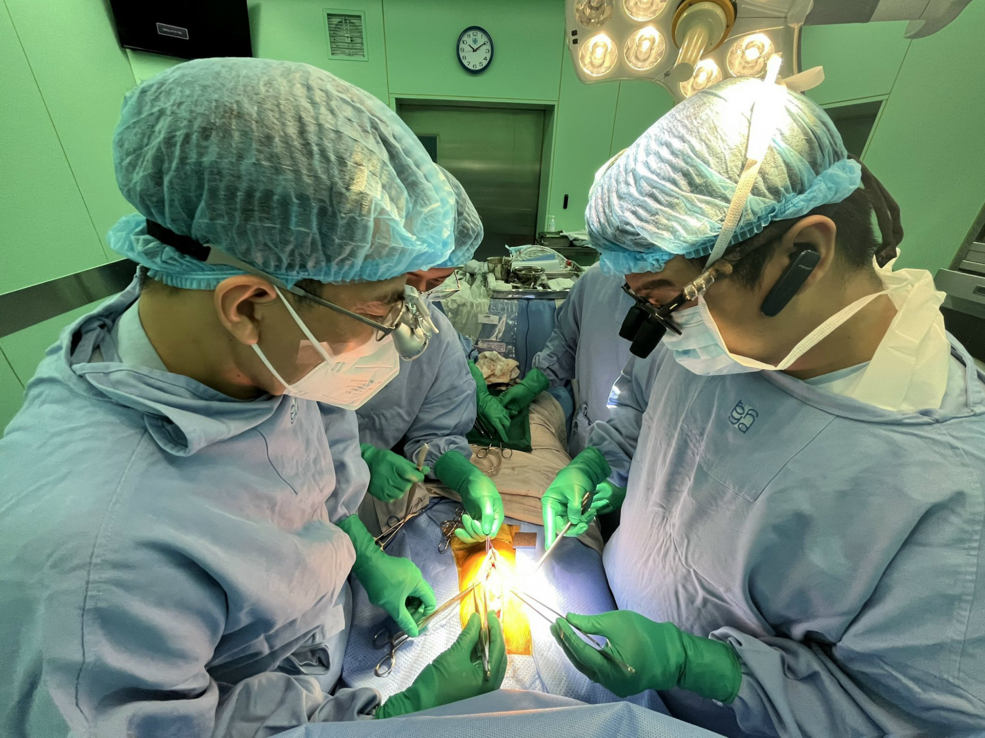Ca phẫu thuật kéo dài 6 tiếng, dưới sự phối hợp của các bác sĩ Bệnh viện Đại học Y dược TPHCM và Bệnh viện Nhi Đồng 2. Ảnh: D. T.