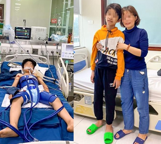 Bé trai tại Tuyên Quang hồi phục kỳ diệu sau khi ngừng tim hơn 1 giờ đồng hồ