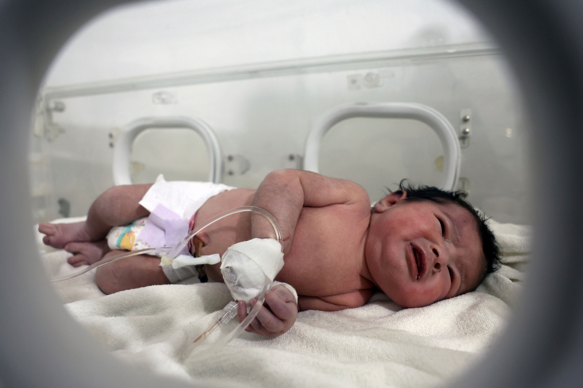 Em bé sơ sinh được cứu sống và được chuyển vào bệnh viện chăm sóc
