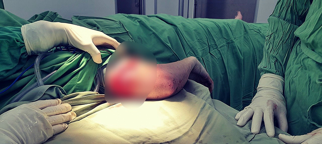 Các bác sĩ tiến hành xử lý vết thương do cho cắn cho du khách - Ảnh bệnh viện cung cấp