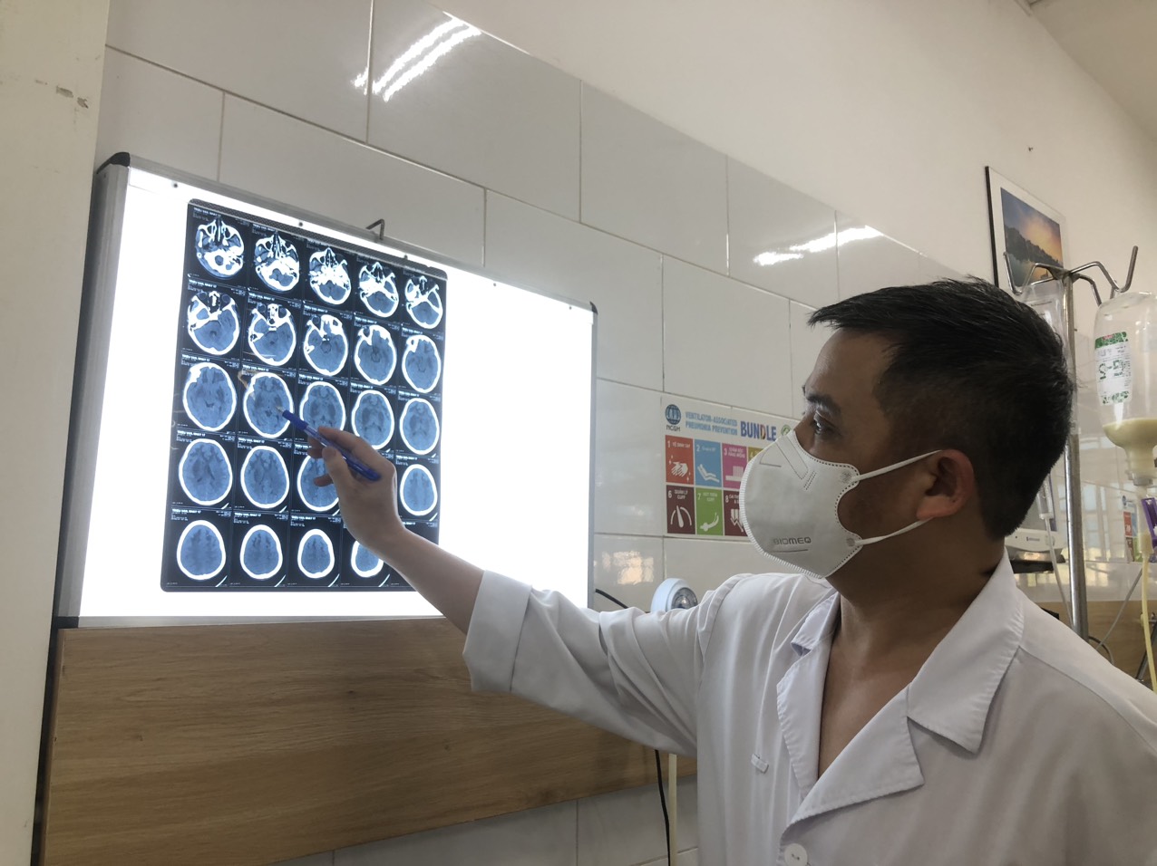 TS.BS Nguyễn Trung Nguyên đánh giá mức độ tổn thương não của bệnh nhân nhiễm độc cồn Methanol