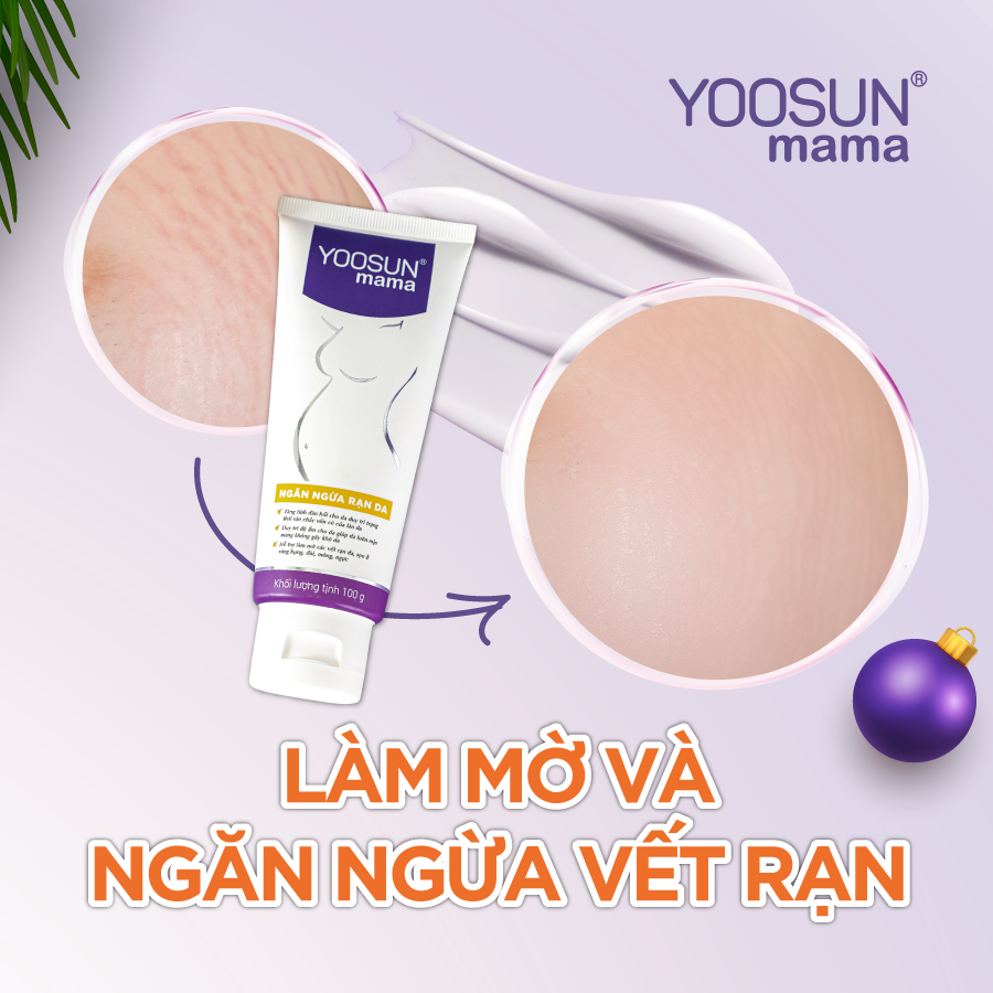 Yoosun Mama - Bảo vệ da - Lành vết rạn