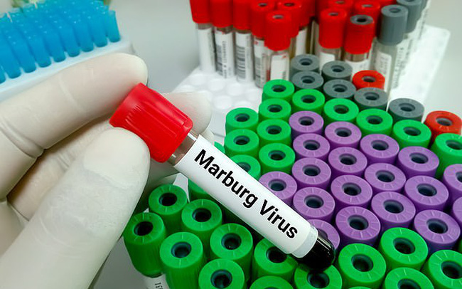 Hiện nay chua có vắc xin và thuốc đặc trị bệnh do virus Marburg gây ra