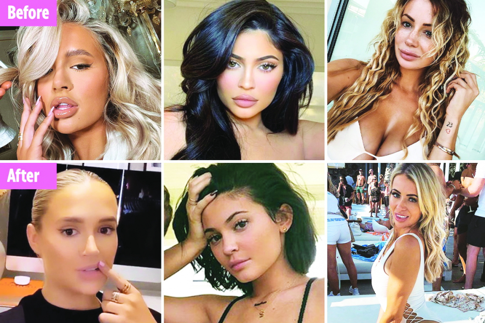 Hình ảnh một số người đẹp nổi tiếng trước (hình trên) và sau (hình dưới) đảo ngược phẫu thuật thẩm mỹ