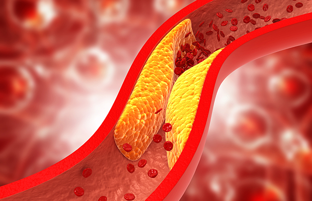 Không phải việc ăn nhiều cholesterol hơn sẽ dẫn đến lượng cholesterol trong máu cao hơn