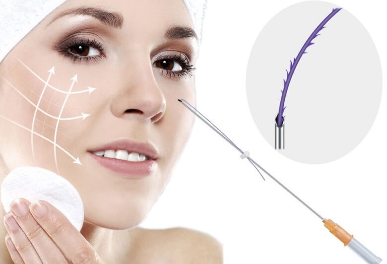 Nâng mũi bằng chỉ collagen là kỹ thuật cải thiện dáng mũi không xâm lấn đảm bảo an toàn - Ảnh: TMV Seoul Center