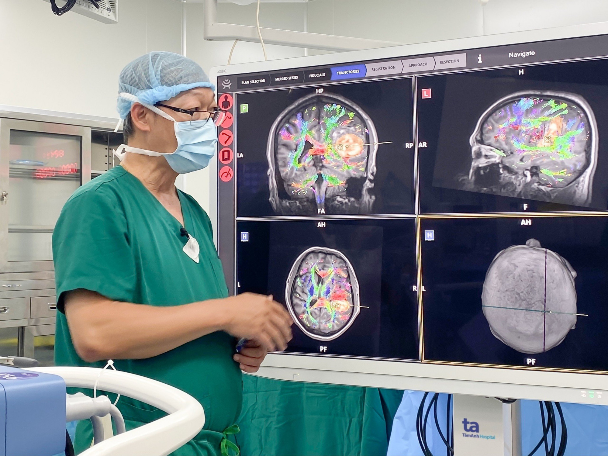 Robot AI hòa hình MRI, DTI cho thấy rõ các bó sợi thần kinh và khối máu tụ chèn ép trong não người bệnh. Ảnh: Nguyễn Trăm