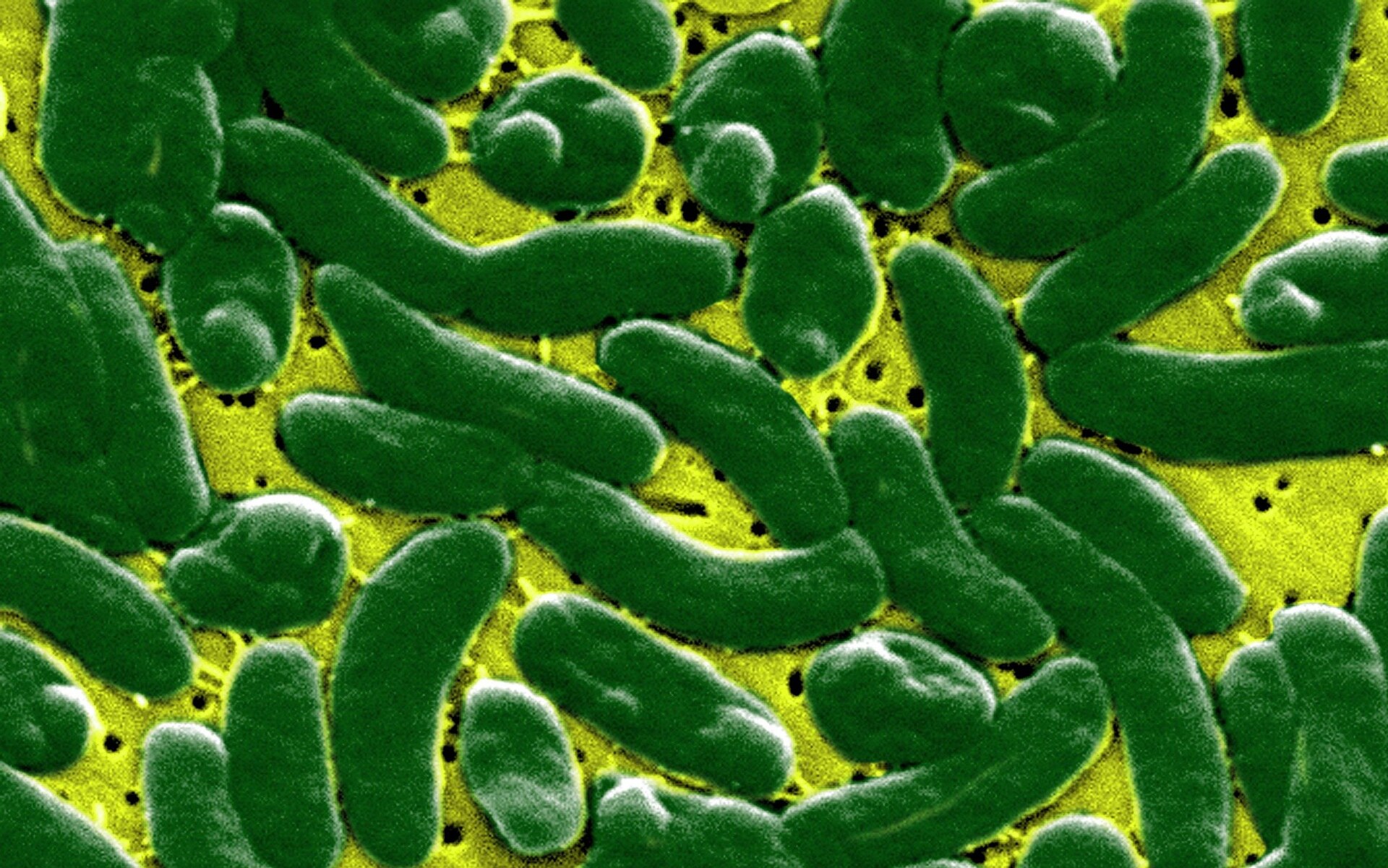 Hình ảnh vi khuẩn Vibrio Vulnificus dưới kính hiển vi – Ảnh: Alamy
