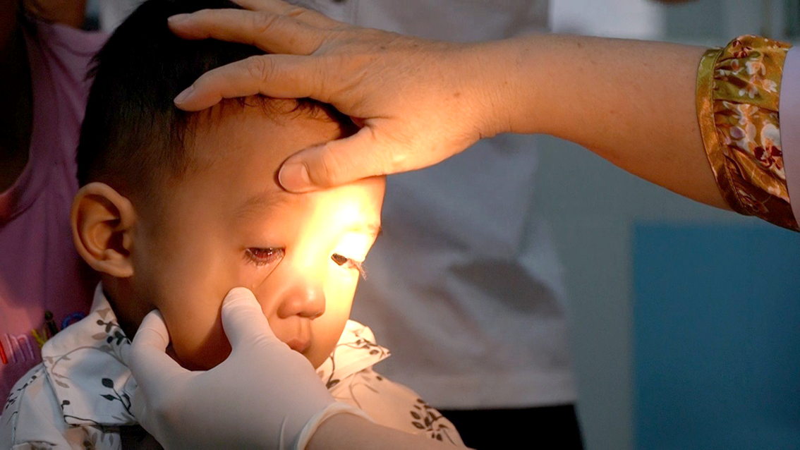 Bệnh nhi bị đau mắt đỏ được bác sĩ tại Bệnh viện Nhi Đồng 2 thăm khám