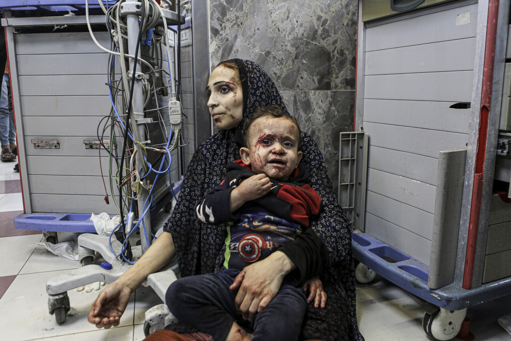 Người Palestine bị thương chờ được điều trị tại bệnh viện al-Shifa, ở Gaza.
