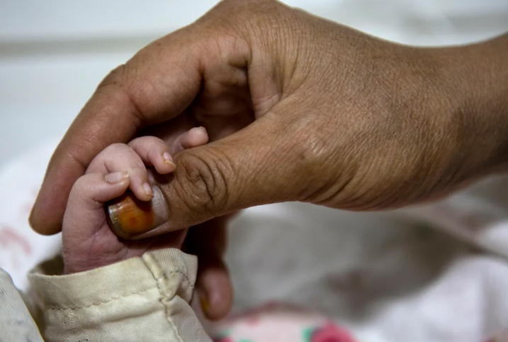 Việc tiếp cận dịch vụ chăm sóc trước và sau sinh của phụ nữ [luôn] cực kỳ phức tạp. Ngày nay mọi chuyện thậm chí còn phức tạp hơn', Filipe Ribeiro, giám đốc MSF tại Afghanistan cho biết. [Kobra Akbari/AFP]