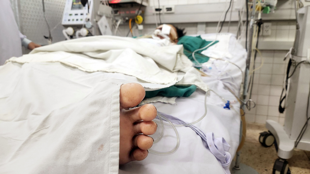 Thiếu niên 15 tuổi bị đa chấn thương vì chế tạo pháo gây nổ đang được điều trị tại Bệnh viện Nhi Đồng 2, tiên lượng xấu - ảnh: phạm an