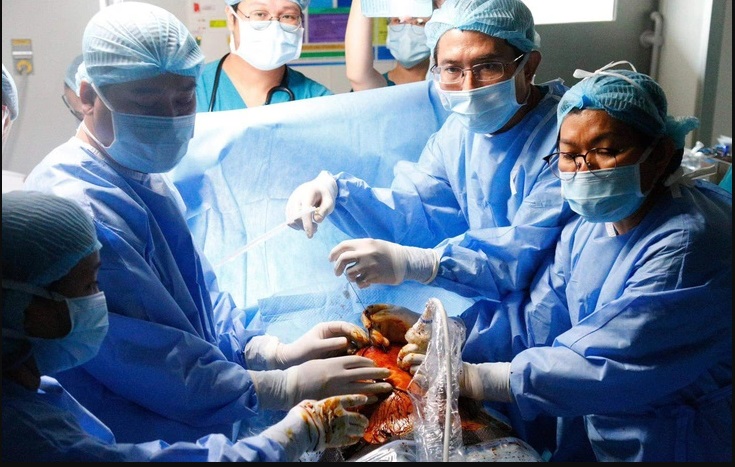 Ê kíp bác sĩ Bệnh viện Nhi đồng 1 và Bệnh viện Từ Dũ thực hiện can thiệp bào thai trong ca đầu tiên - Ảnh: Bệnh viện cung cấp