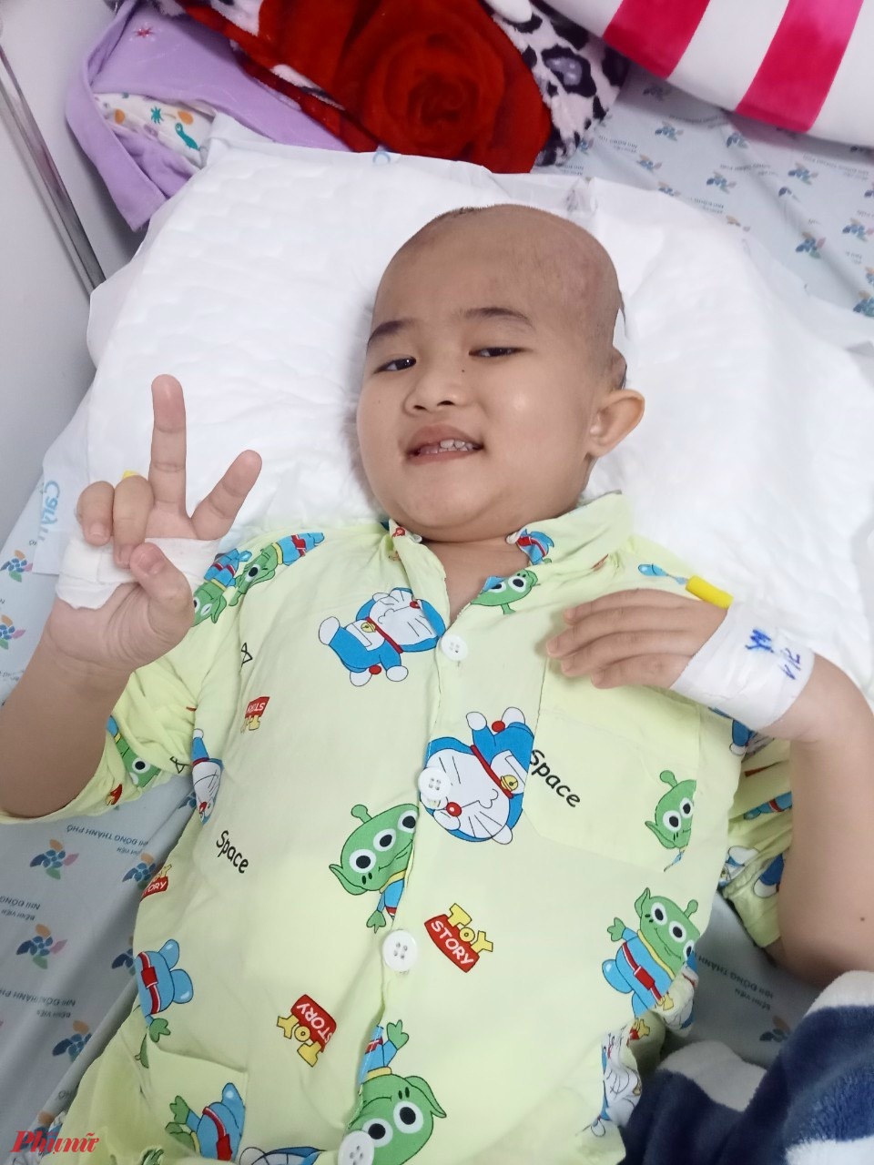 Bé Lam đang điều trị tại bệnh viện