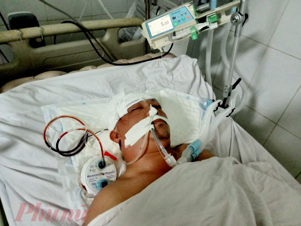 Anh Tô Xuân Bính đang điều trị tích cực tại Bệnh viện Hữu nghị đa khoa Nghệ An