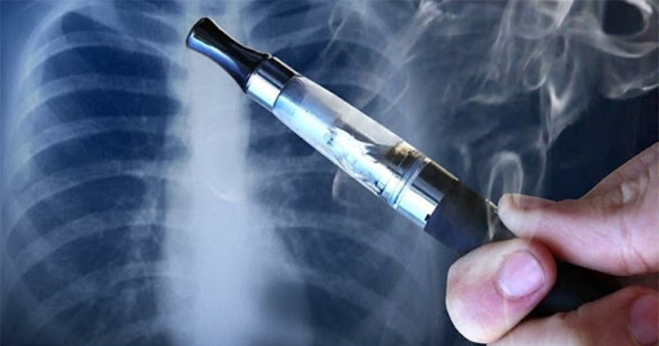 Các bác sĩ cảnh báo hút thuốc lá điện tử trong phòng kín dễ tổn thương phổi cấp tính