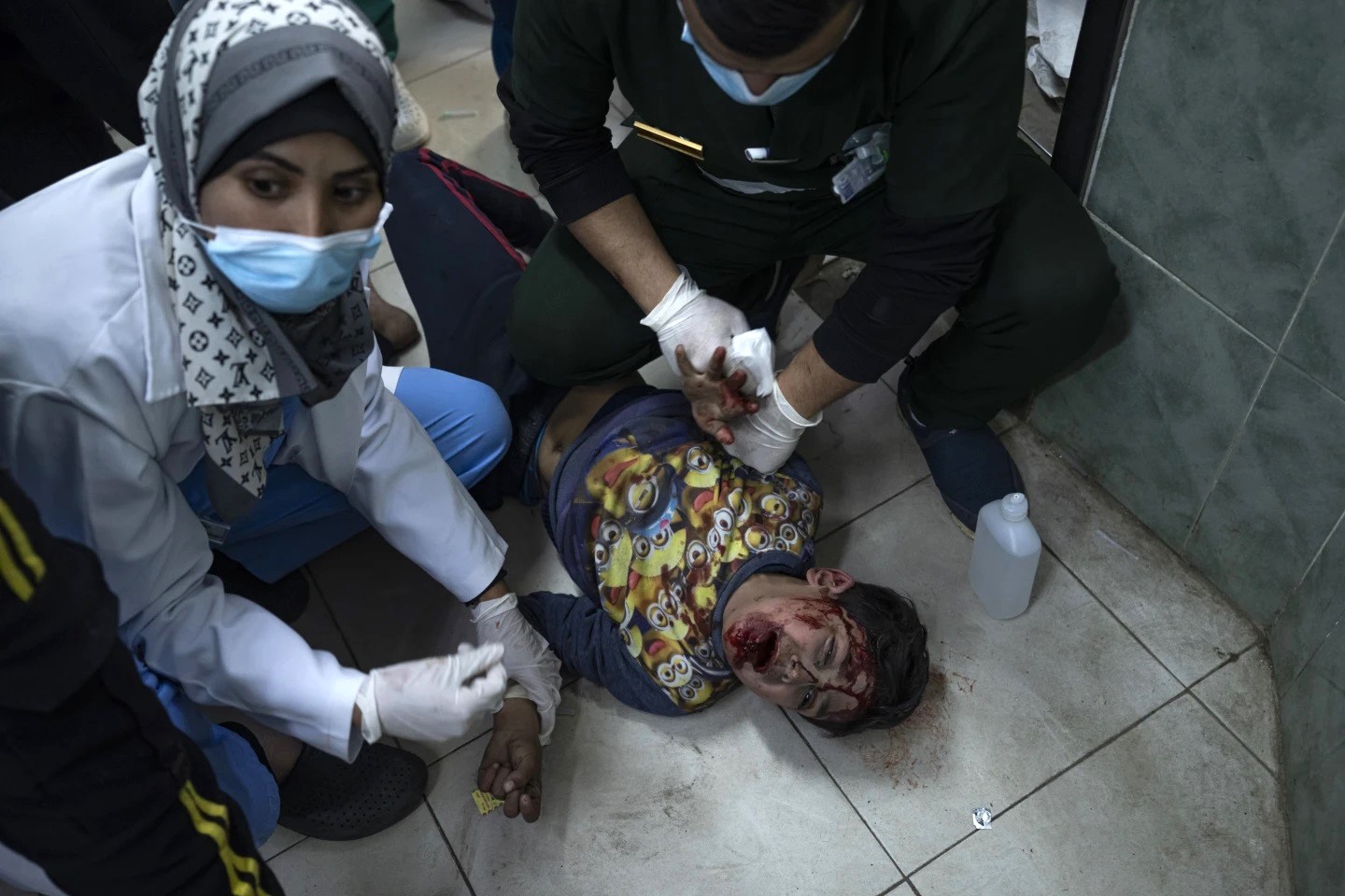 Một đứa trẻ người Palestine bị thương do bom đạn được đưa đến bệnh viện Al-Najjar ở thành phố Rafah vào ngày 24/2 - Ảnh: AP