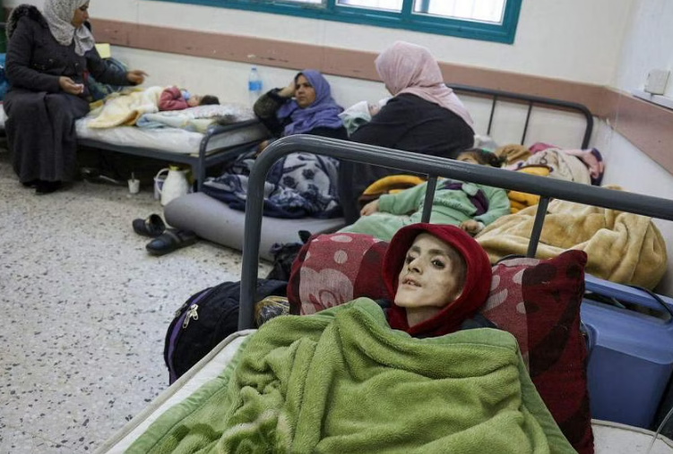 Bức ảnh tháng 2/2024 cho thấy Yazan al-Kafarna, một cậu bé bị bại não, trên giường bệnh ở Rafah. Em qua đời ngày 4/3. ẢNH: AFP
