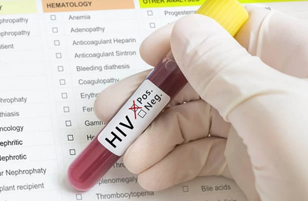 Người đàn ông nhiễm HIV hiến máu 11 lần mới bị phát hiện