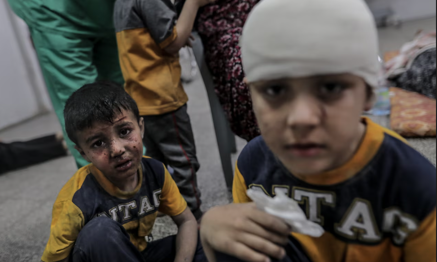 Trẻ em Palestine bị thương đang chờ điều trị tại bệnh viện Abu Yousef Al-Najjar, Rafah, ngày 25 tháng 4 năm 2024. Ảnh: Anadolu/Getty Images