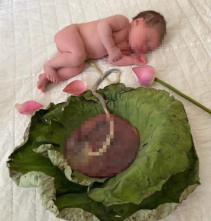 'Lotus birth hay sinh sen, liên sinh thực ra không liên quan gì đến hoa hay lá sen, mà xuất phát từ tên của bà Clair Lotus - người khởi xướng phương pháp này.