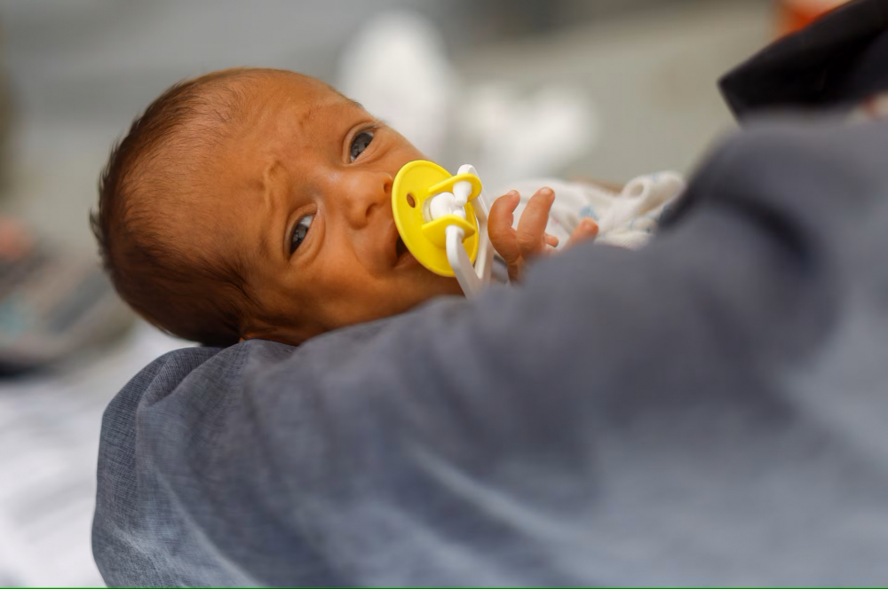 Em bé Palestine bị suy dinh dưỡng đang điều trị tại bệnh viện dã chiến của Quân đoàn Y tế Quốc tế ở Deir Al-Balah, phía nam Dải Gaza - Ảnh: REUTERS/Mohammed Salem