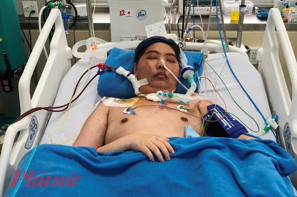 Em Lê Phan Quốc An đang điều trị tại bệnh viện Chợ Rẫy (TPHCM)