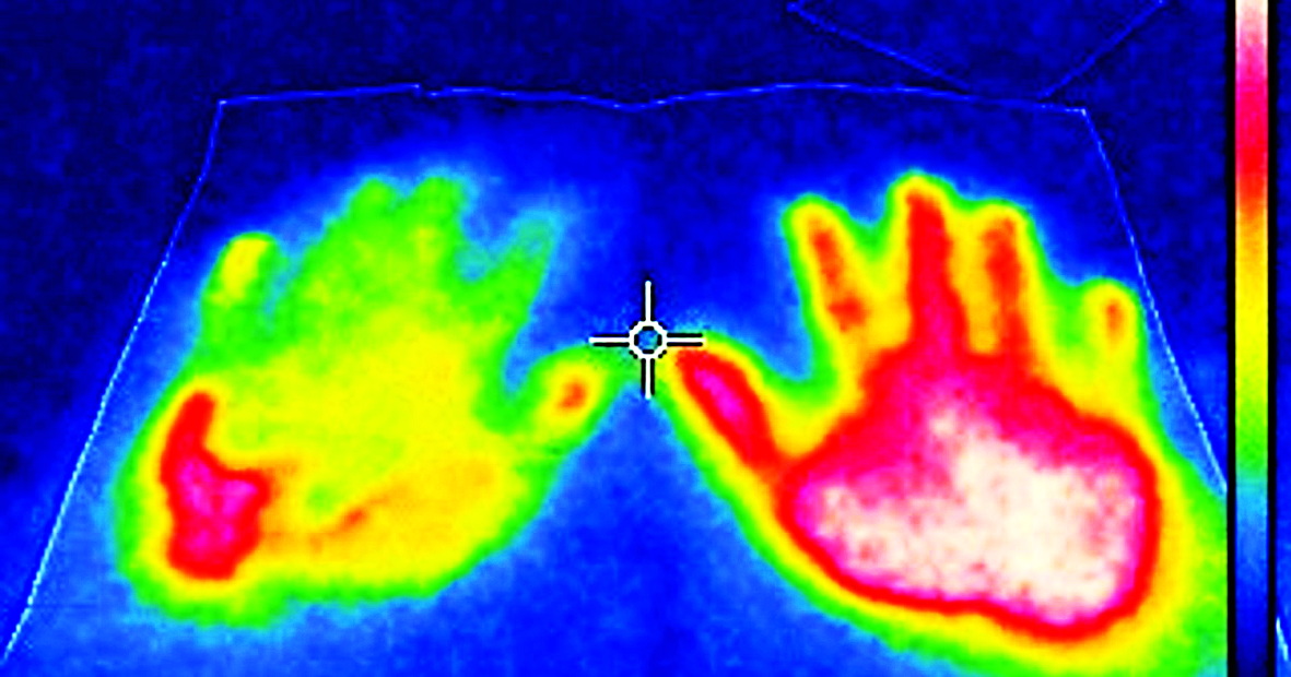 Hình ảnh cho thấy sự phân bổ nhiệt của một bàn tay trên  “giấy làm mát” bên trái và một bàn tay trên giấy thông thường.  Màu đỏ biểu thị nhiệt độ cao hơn - Nguồn ảnh: Ehime Institute  of Industrial Technology’s Paper Technology Center