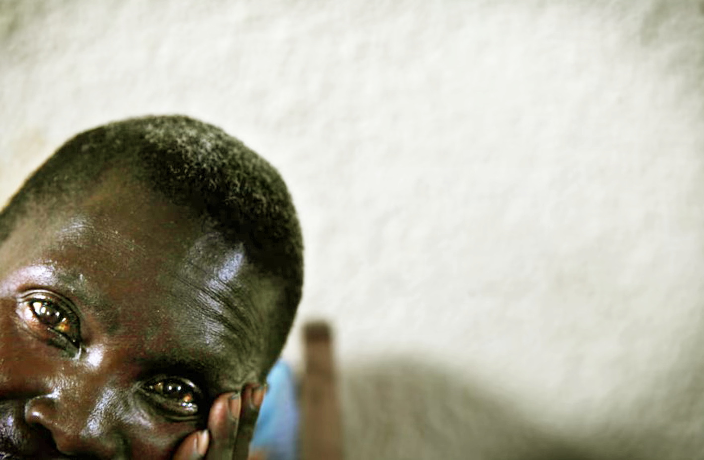 Một bệnh nhân tâm thần tại Trung tâm Santé Mentale ở Congo, nơi nhiều năm chiến tranh đã gây tổn hại nặng nề  đến sức khỏe tâm thần của người dân - Nguồn ảnh: Kuni Takahashi/Getty Images