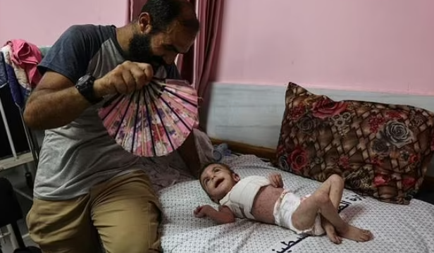 Theo Tổ chức Y tế Thế giới, hơn 1250.000 người đã mắc các bệnh về da ở Dải Gaza bị chiến tranh tàn phá