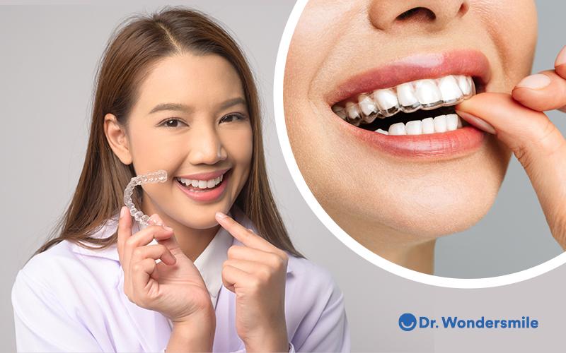 Niềng răng trong suốt được đánh giá cao bởi tính thẩm mỹ - Ảnh: Wonder Smile