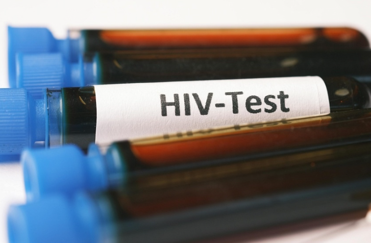 Các trường hợp nhiễm HIV và tử vong đang giảm là 'Tiến bộ đáng chú ý trên toàn cầu': 