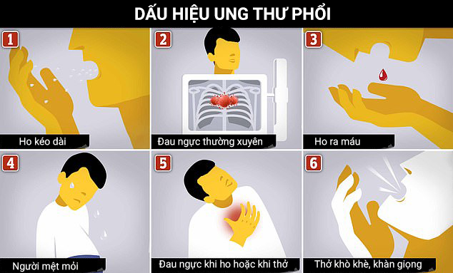 Không nên xem ung thư phổi là bệnh của người già, phụ nữ cũng được khuyến cáo không nên bỏ qua cơn ho dai dẳng. Ảnh: mailonline.