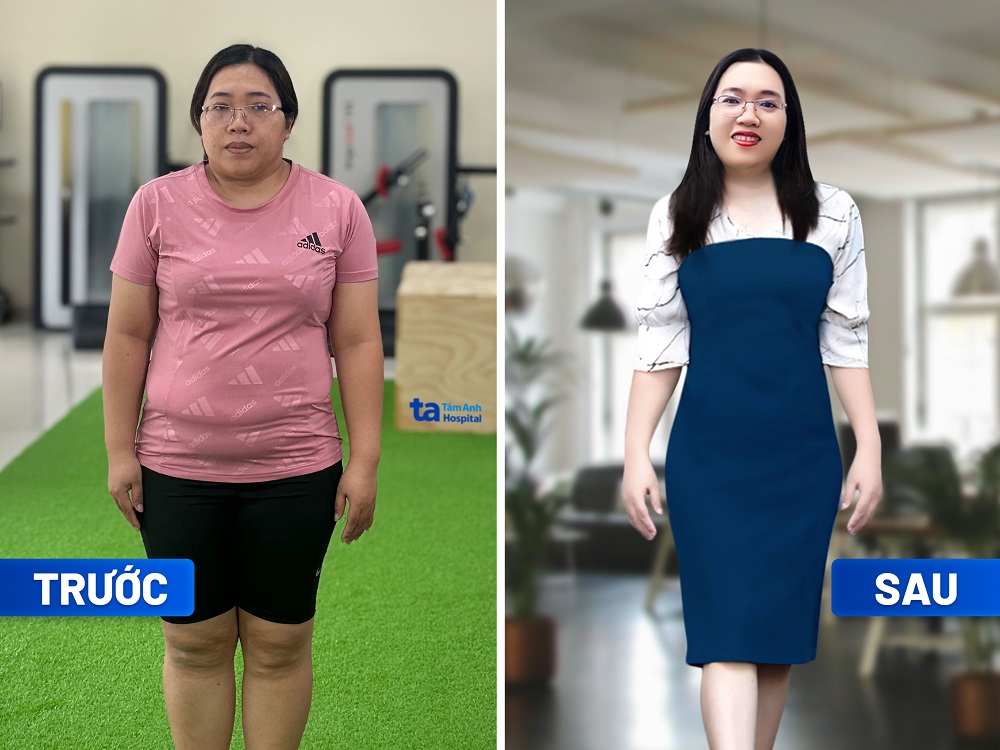 Chị Phạm Thị Ánh Dương giảm 7kg trong 3 tháng tại Trung tâm Giảm cân Tâm Anh. Chị không thấy mệt, không mất sức, không kiêng ăn quá mức, không bị stress - Ảnh: BVĐK Tâm Anh