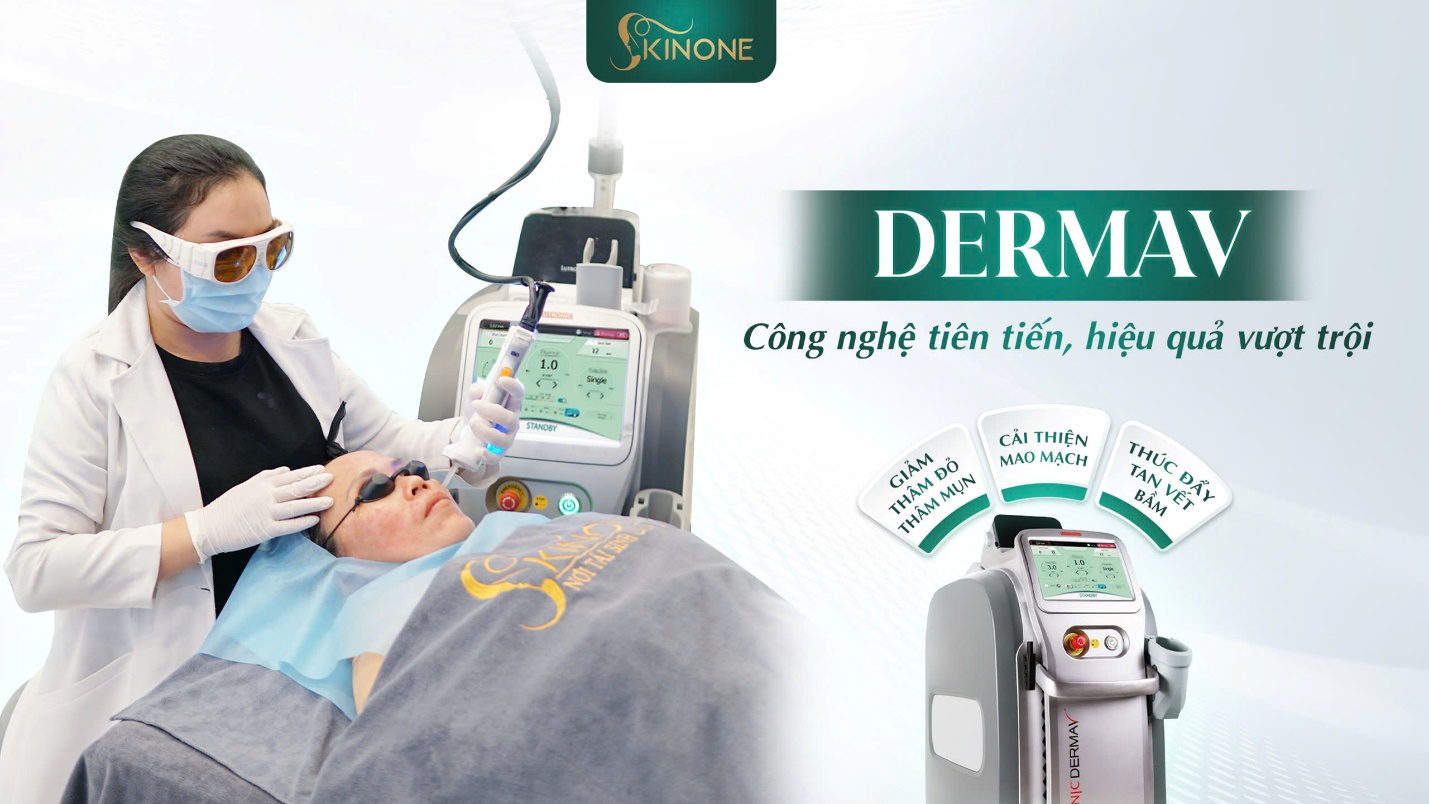 DERMAV - Công nghệ trị mao mạch tiên tiến, hiệu quả vượt trội - Ảnh: SKINONE