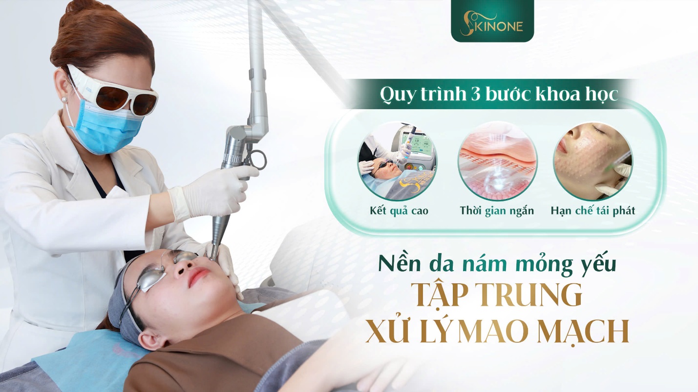 SKINONE tập trung xử lý hệ thống mao mạch máu dưới da - Ảnh: SKINONE