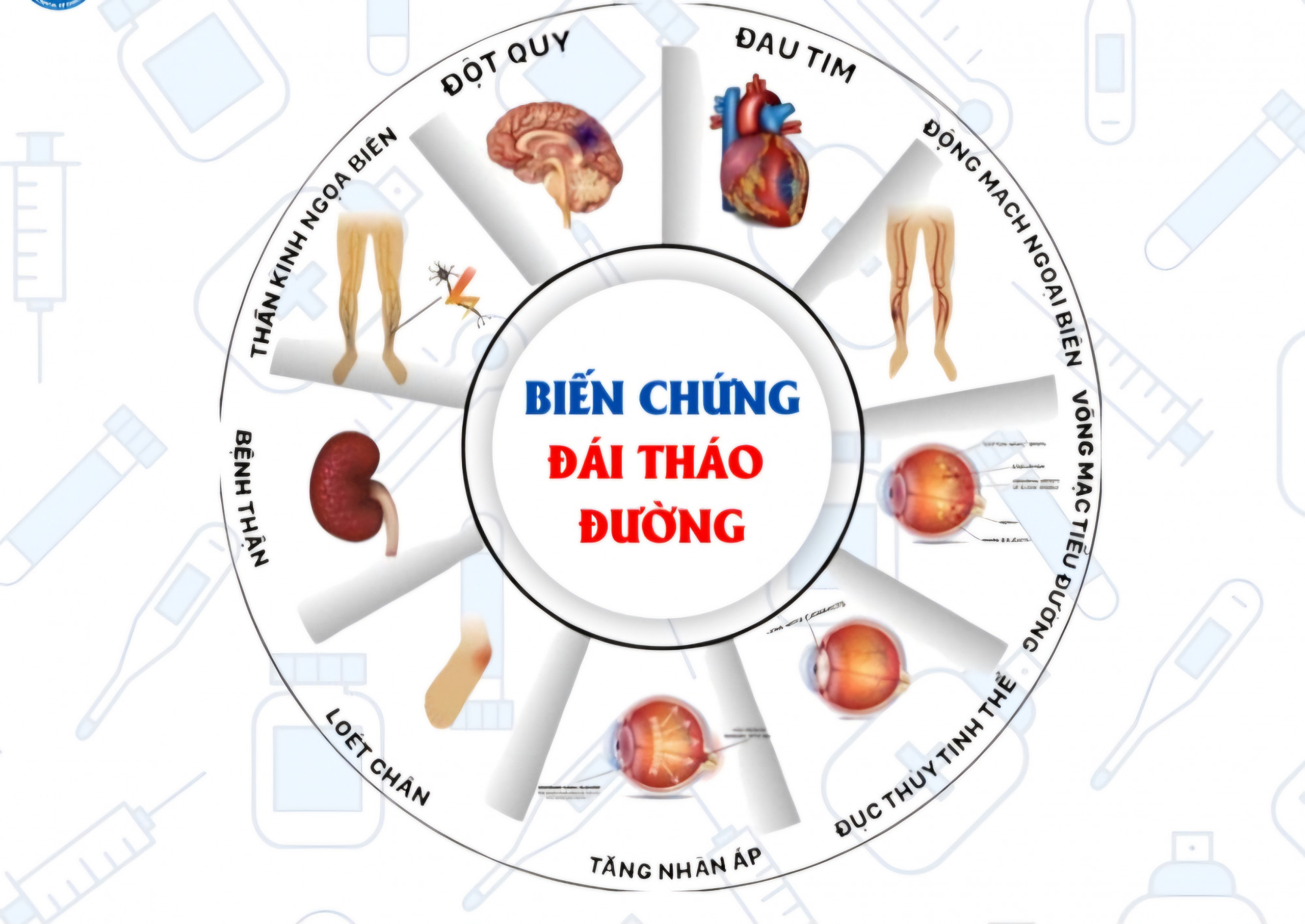 Các biến chứng nguy hiêmt của tiểu đường - ảnh BVCC